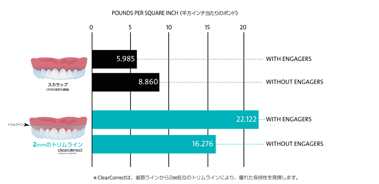 フィット感に優れたマウスピースの設計