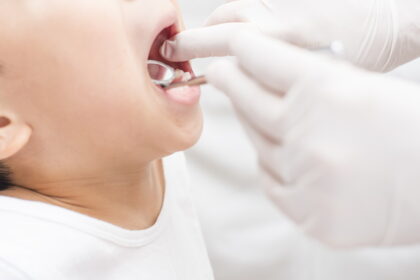 子どもの頃から歯医者に行く習慣づけがおすすめ
