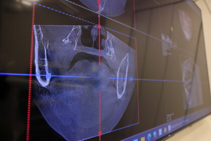 不安を緩和させるための密なカウンセリング