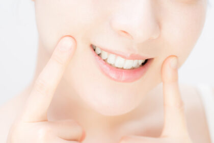 前歯だけの部分矯正