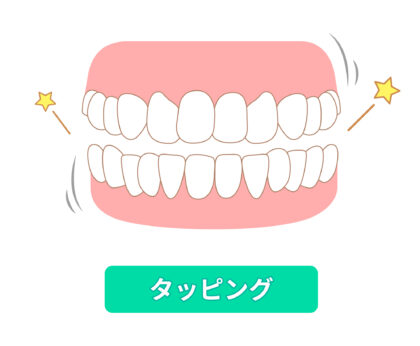 歯ぎしり・食いしばりとは？