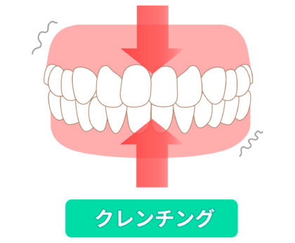 歯ぎしり・食いしばりとは？