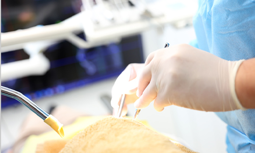 事前の麻酔にも力を入れて、なるべく痛みの少ない治療を実現