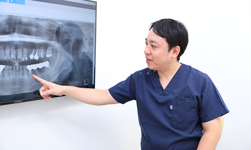 歯を残すことを第一に考えて、複数の選択肢をご用意